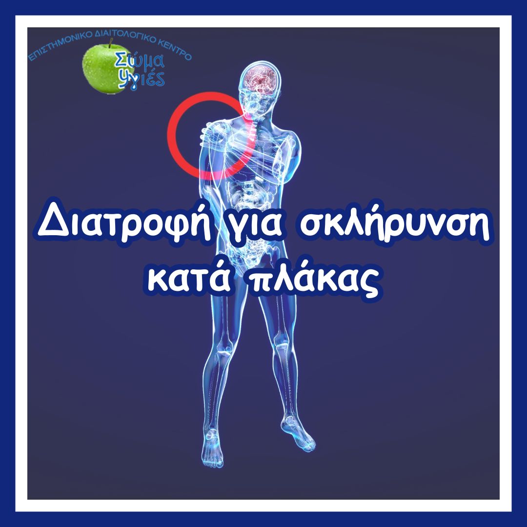 Διατροφή για σκλήρυνση κατά πλάκας